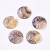 Mother of Pearl Buttons X-BSHE-K012-10A-1
