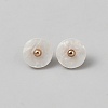 1-Hole Shank Buttons BUTT-WH20002-30B-1