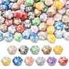100Pcs UV Plating Acrylic Beads PACR-CJ0001-20-1