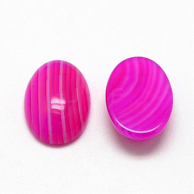Natural Striped Agate/Banded Agate Cabochons G-R415-18x25-13-1